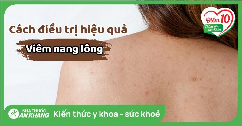 Cac buoc cham soc da tay bi viem nang long tai nha, ve sinh, chuom am