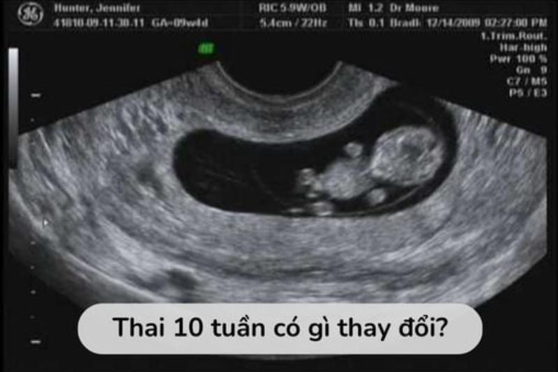 Một cô gái trẻ đang nghe nhạc C-pop bằng tai nghe trong kỳ lịch nghỉ 30-4, thư giãn tại nhà.