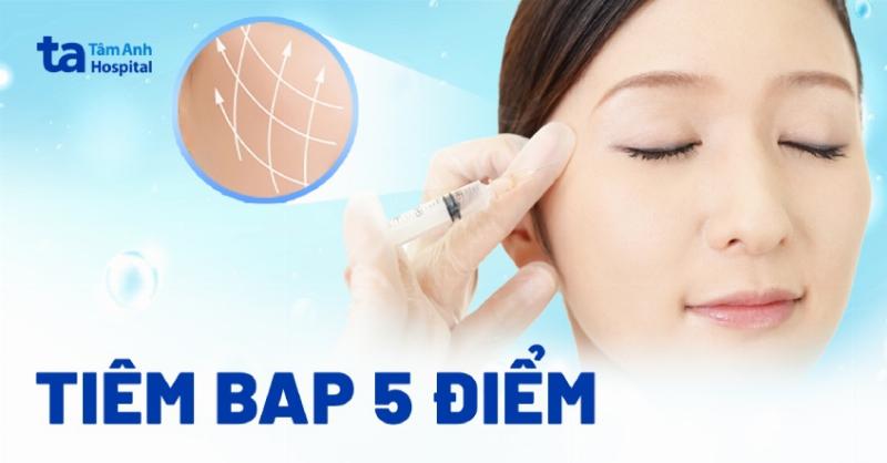 Hình ảnh minh họa cơ chế hoạt động của filler giúp nâng đỡ cấu trúc da và mô mềm, giải thích cách nó chống lại sự chảy xệ do mất thể tích.