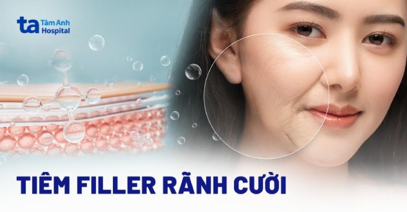 Sơ đồ minh họa quá trình lão hóa khuôn mặt cho thấy sự mất thể tích mỡ dưới da và thay đổi cấu trúc xương, giải thích tiêm filler có bị chảy xệ không liên quan trực tiếp.